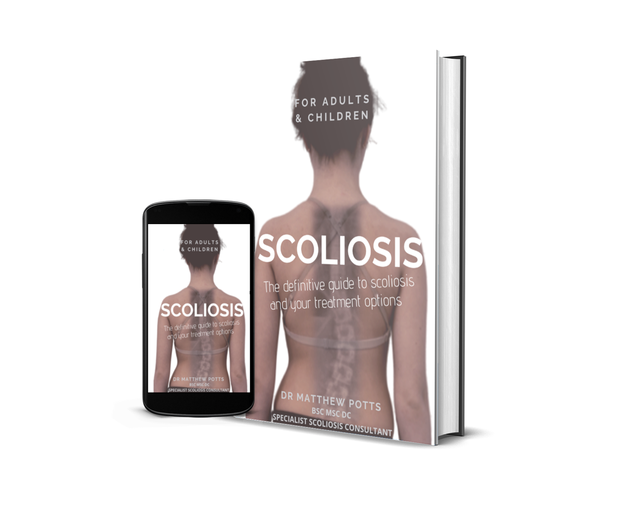 scoliosis book